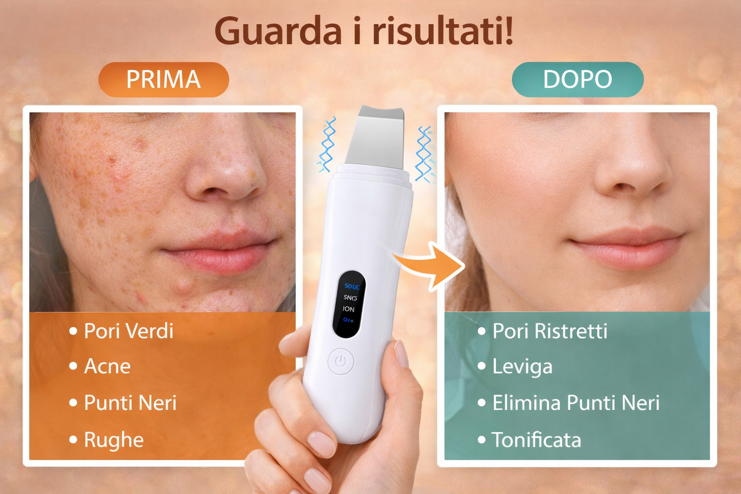 Peeling viso Scrubber Pulizia Viso Ultrasuoni Spatola Punti Neri Professionale