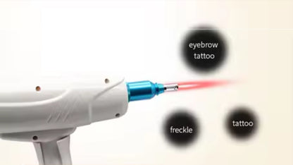 Laser per eliminazione tatuaggi multicolore (nero, rosso, blu)